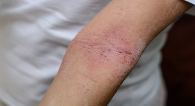 dermatology
